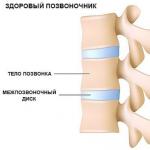 Choroby chrbtice a ich príznaky