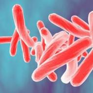 Symptoms and first signs of tuberculosis in adults