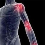 Ako liečiť reumu kĺbov Ako liečiť reumu