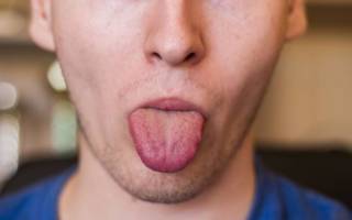 Uzroci ukočenosti usana i jezika